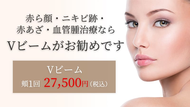 赤ら顔・ニキビ跡・赤あざ・血管腫治療ならVビームがお勧めです。Vビーム頬1回 27,500円(税込)