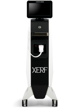 XERF